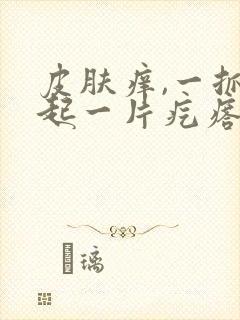 皮肤痒,一抓就起一片疙瘩封面