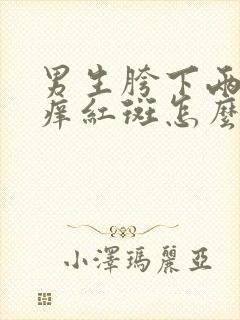 男生胯下两侧瘙痒红斑怎么办