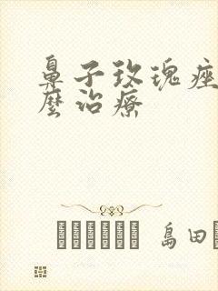 鼻子玫瑰痤疮怎么治疗