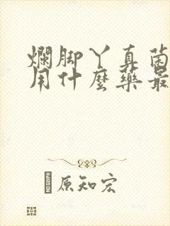 烂脚丫真菌感染用什么药最好