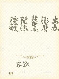 腰间盘膨出下肢酸胀怎么办