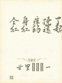 全身痒挠了一片红红的还起红疙瘩