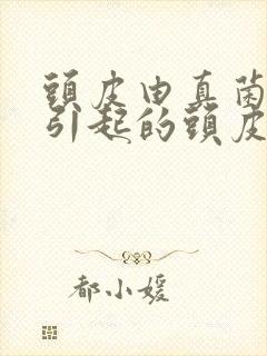 头皮由真菌感染引起的头皮屑怎么治