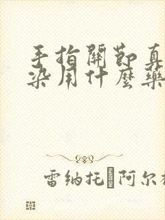 手指关节真菌感染用什么药最好