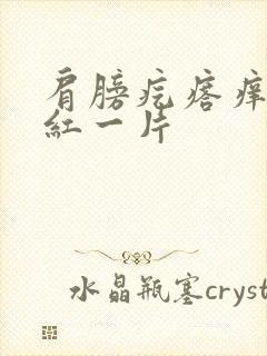 肩膀疙瘩痒抓了红一片