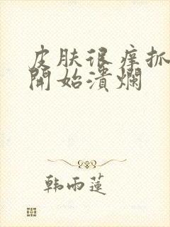 皮肤很痒抓破皮开始溃烂