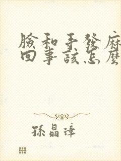 脸和手发麻怎么回事该怎么办