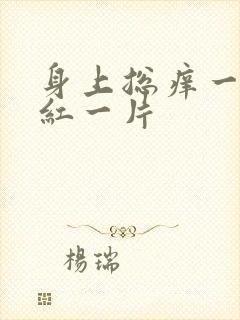 身上总痒一挠就红一片