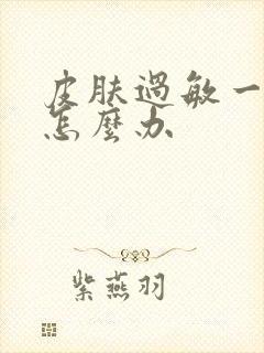 皮肤过敏一直痒怎么办