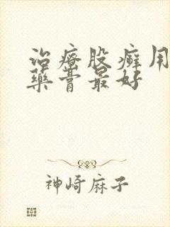 治疗股癣用什么药膏最好