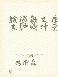 脸过敏又痒又红又肿吃什么药