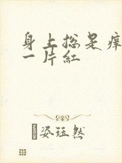 身上总是痒一挠一片红
