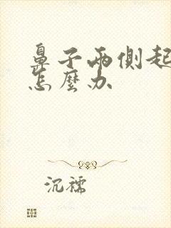 鼻子两侧起痤疮怎么办