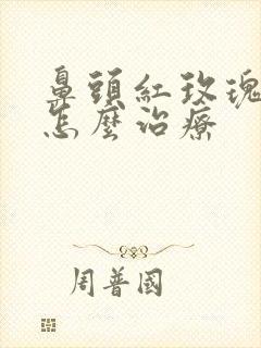 鼻头红玫瑰痤疮怎么治疗