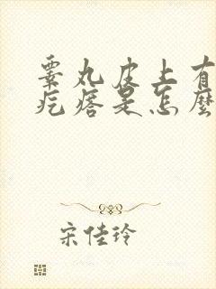 睾丸皮上有小白疙瘩是怎么回事