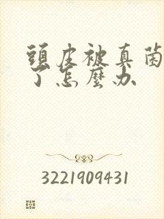 头皮被真菌感染了怎么办