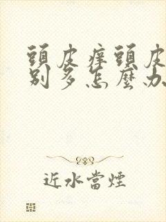 头皮痒头皮屑特别多怎么办啊