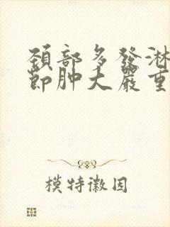 颈部多发淋巴结节肿大严重吗