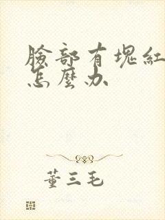 脸部有块红色癣怎么办