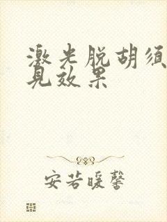 激光脱胡须几次见效果