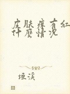 皮肤痒有红点是什么情况封面