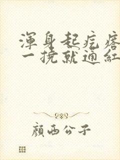 浑身起疙瘩痒痒一挠就通红封面