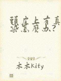 头皮上有真菌感染怎么办?