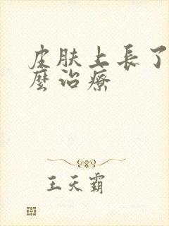 皮肤上长了癣怎么治疗