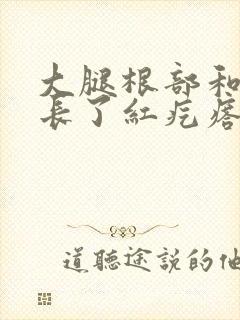 大腿根部和腋下长了红疙瘩很痒