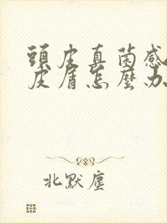 头皮真菌感染头皮屑怎么办