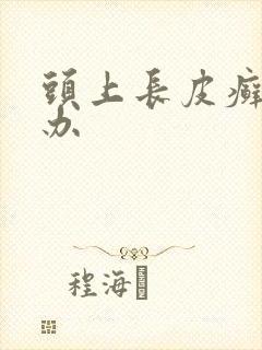 头上长皮癣怎么办