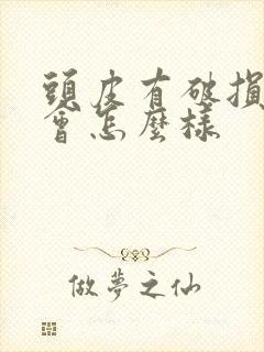 头皮有破损染发会怎么样封面