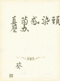 真菌感染头痒怎么办