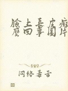 脸上长皮癣是怎么回事图片
