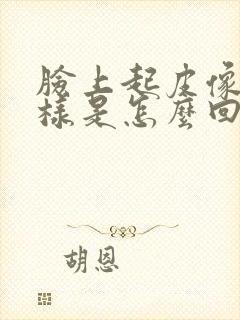 脸上起皮像癣一样是怎么回事