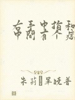 右手中指和食指中间有个痣封面
