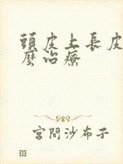 头皮上长皮癣怎么治疗