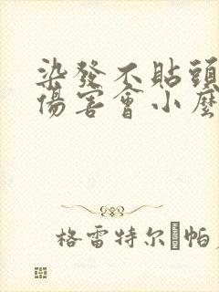 染发不贴头皮,伤害会小么