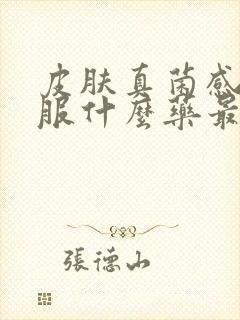 皮肤真菌感染口服什么药最好