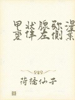 甲状腺弥漫性改变伴左侧叶结节