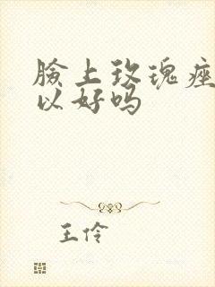 脸上玫瑰痤疮可以好吗