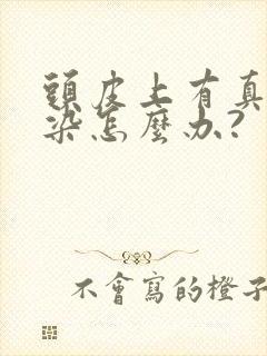 头皮上有真菌感染怎么办?
