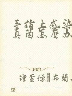 手指上感染脚气真菌怎么办封面