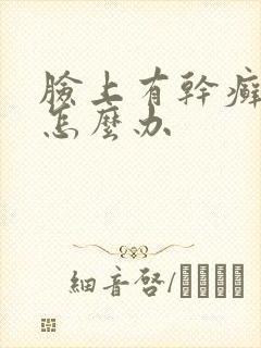 脸上有干癣起皮怎么办