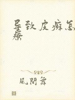 导致皮癣怎么治疗