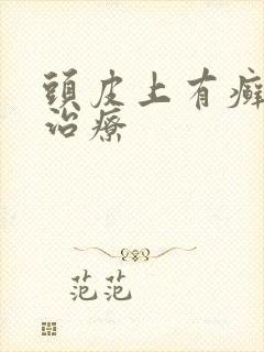 头皮上有癣怎么治疗