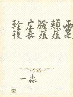 干皮脸颊两边反复长痘痘是什么原因引起的