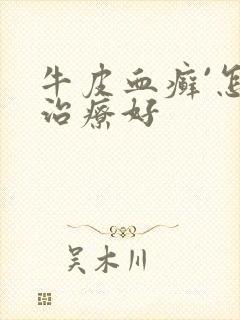牛皮血癣`怎么治疗好
