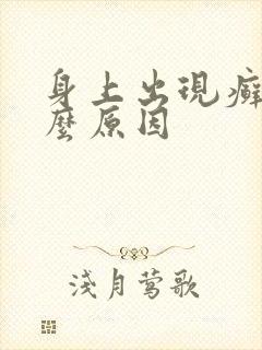 身上出现癣是什么原因