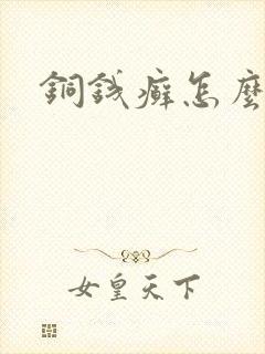 铜钱癣怎么消除